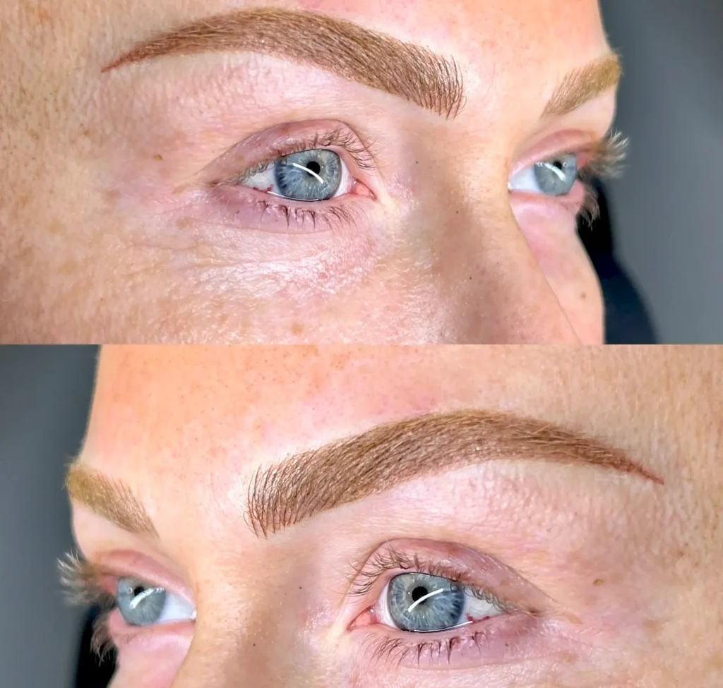 Brow Healing Timeline