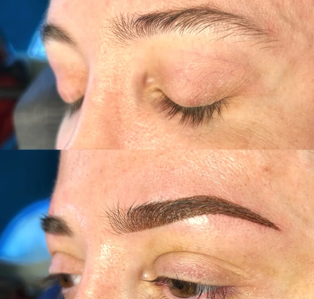 Does Skin Type Matter