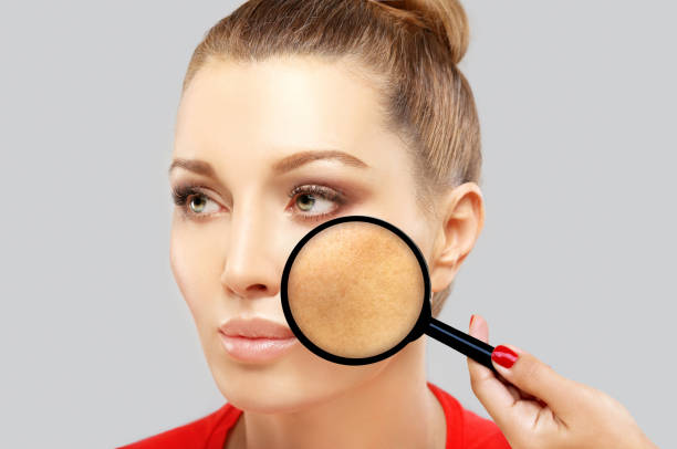 Close-up of woman examining skin with magnifying glass, focusing on facial details and complexion