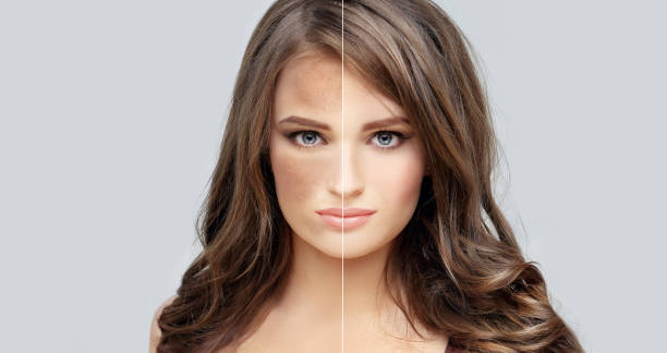 Fight Hyperpigmentation: Discover Top Skin-Brightening Ingredients | Skin Health Guide