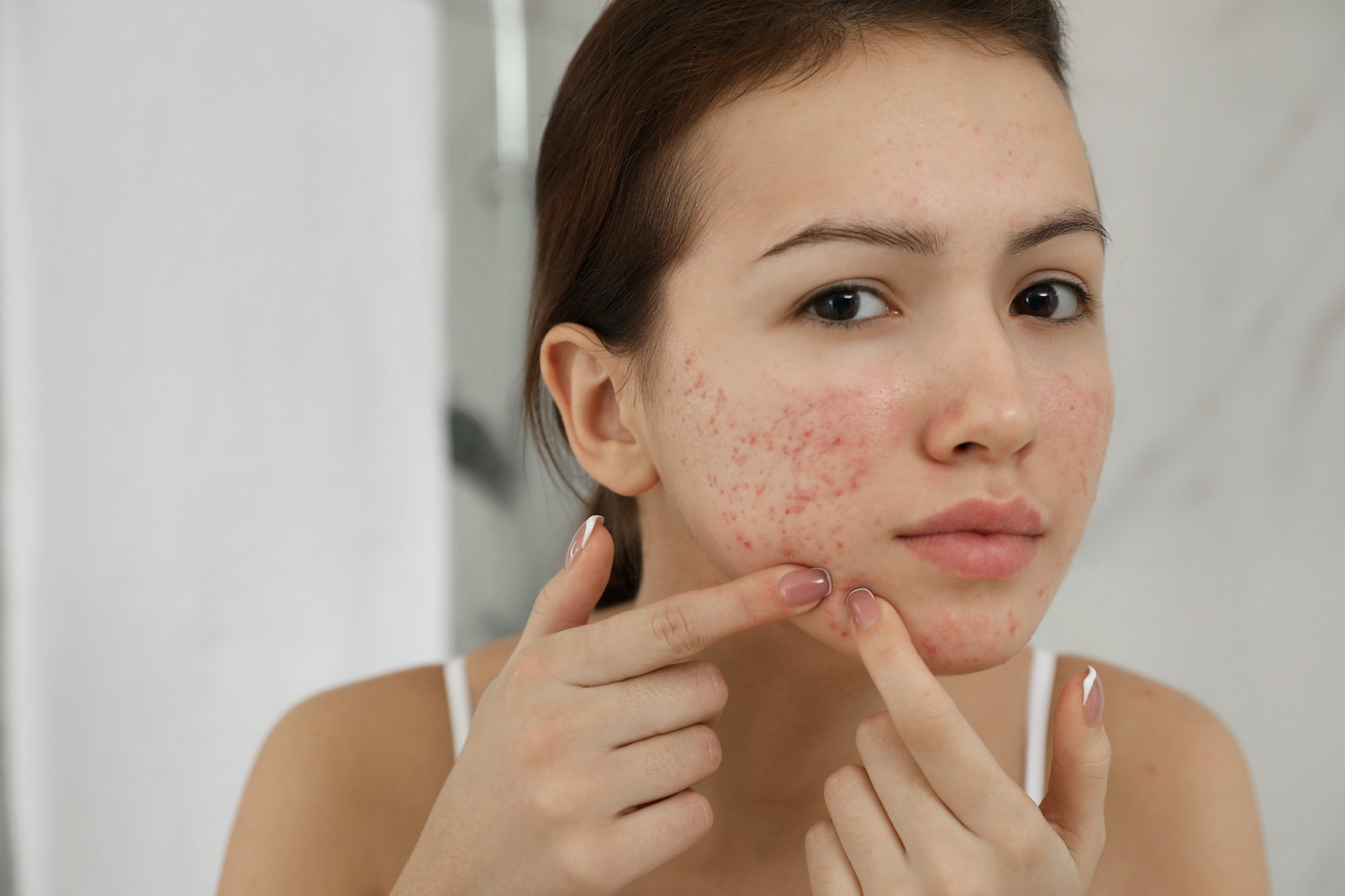 Learn about the duration for a blind pimple to go away and effective remedies.